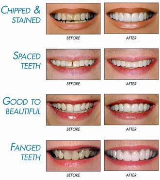 Cosmetic-Dentistry
