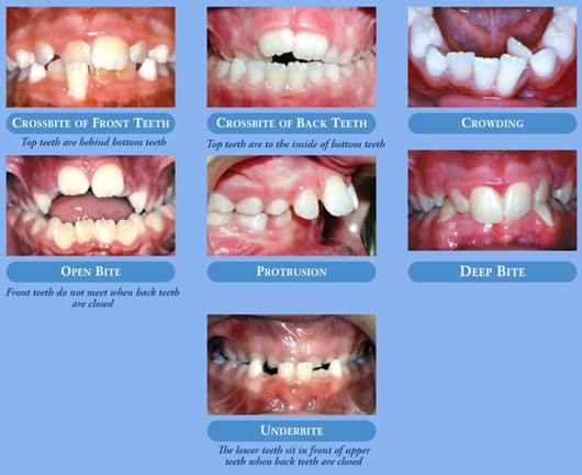 Ortho cases