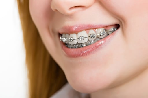 TLC Dental Care Orthodontics