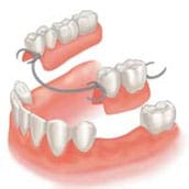 partial dentures